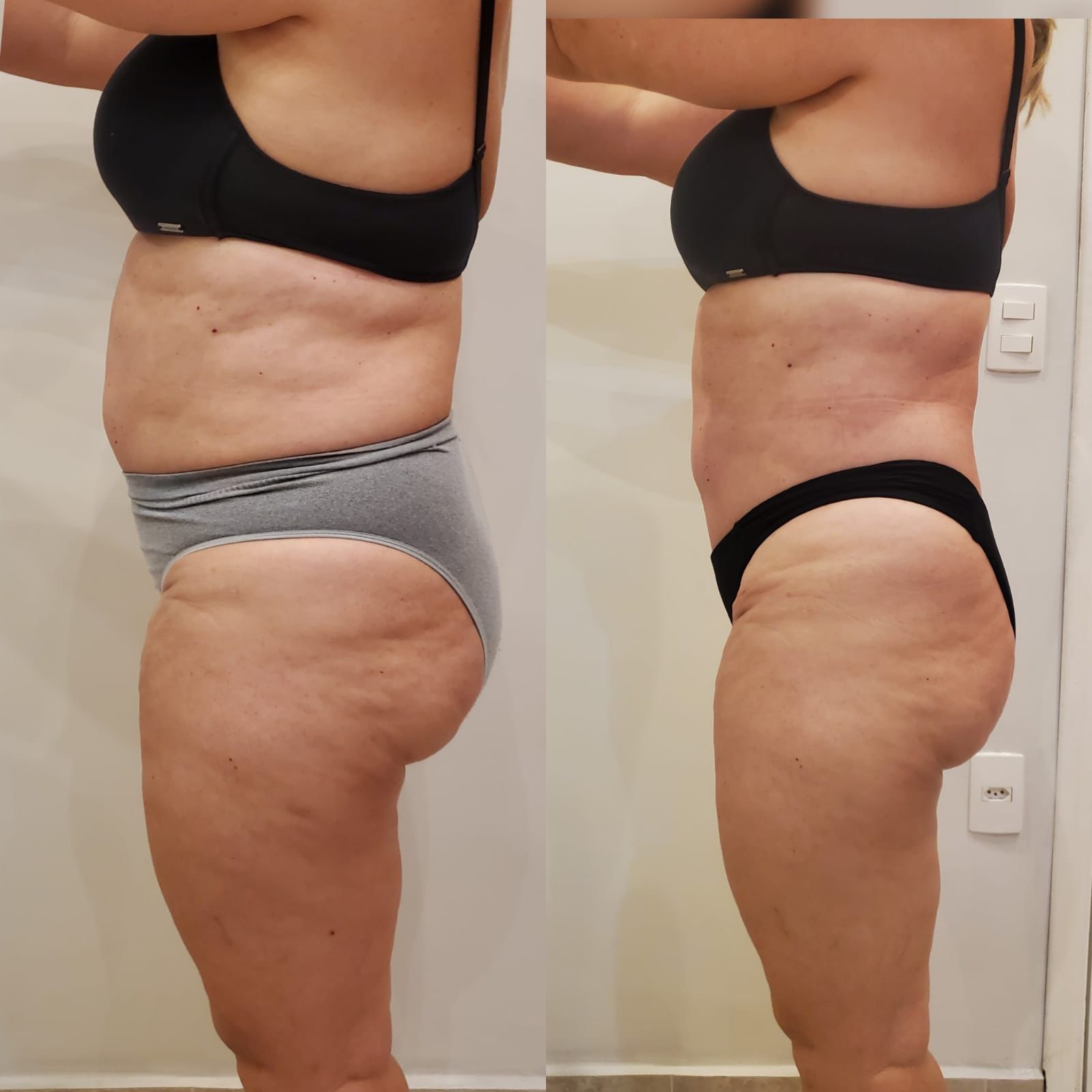 Resultado Antes e Depois de Aluna